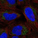 ARHGAP20 Polyclonal Antibody