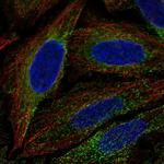 FAM62A Polyclonal Antibody