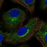 AMFR Polyclonal Antibody