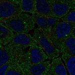 FCHO2 Polyclonal Antibody