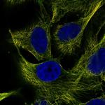 ZNF654 Polyclonal Antibody