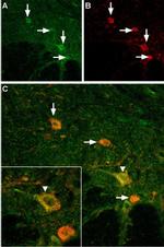 TRPV3 (extracellular) Antibody in Immunohistochemistry (IHC)