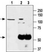 TRPA1 (extracellular) Antibody in Immunoprecipitation (IP)