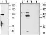 TRPA1 (extracellular) Antibody in Western Blot (WB)