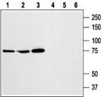 STIM1 (extracellular) Antibody in Western Blot (WB)