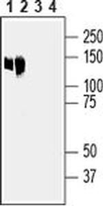 ANO6 (extracellular) Antibody in Western Blot (WB)