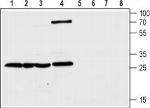 CLIC1 Antibody in Western Blot (WB)