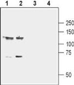 EphB1 (extracellular) Antibody in Western Blot (WB)