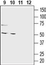 GPR120 (extracellular) Antibody in Western Blot (WB)