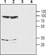 NMDAR3B (extracellular) Antibody in Western Blot (WB)