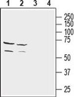NETO2 (extracellular) Antibody in Western Blot (WB)