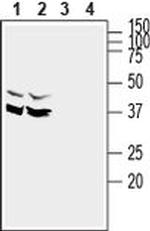 SYNDIG1 Antibody in Western Blot (WB)