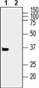SYNDIG1 Antibody in Western Blot (WB)
