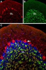 CaV1.2 Antibody in Immunohistochemistry (IHC)