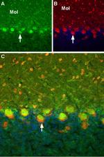 TRPC6 Antibody in Immunohistochemistry (IHC)