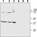 Kir4.1 (KCNJ10) Antibody in Western Blot (WB)