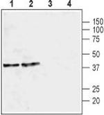 Kir3.2 (KCNJ6) Antibody in Western Blot (WB)