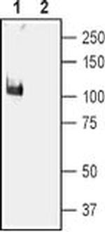 KCNMA1 Antibody in Western Blot (WB)