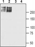 SCN2A Antibody in Western Blot (WB)
