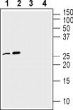 proNGF Antibody in Western Blot (WB)