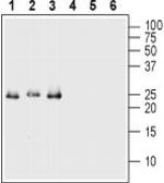 proBDNF Antibody in Western Blot (WB)