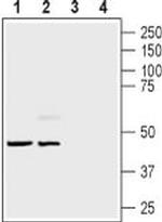 Endothelin B Receptor Antibody in Western Blot (WB)