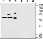 KV4.2 (KCND2) Antibody in Western Blot (WB)