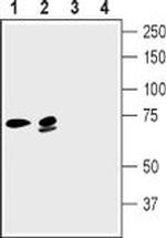 KCNN2 Antibody in Western Blot (WB)