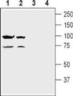 NMDAR1 (extracellular) Antibody in Western Blot (WB)