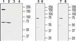KCNQ1 Antibody in Western Blot (WB)