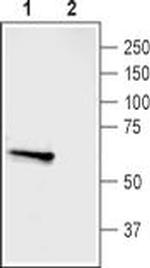 ASIC3 Antibody in Western Blot (WB)