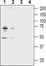 ASIC1 Antibody in Western Blot (WB)