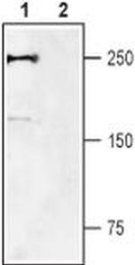 SCN9A Antibody in Western Blot (WB)