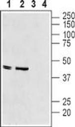 Kir6.2 (KCNJ11) Antibody in Western Blot (WB)