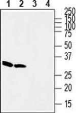 Stargazin Antibody in Western Blot (WB)