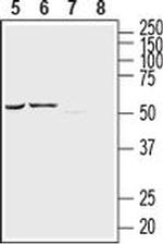 P2Y12 (extracellular) Antibody in Western Blot (WB)