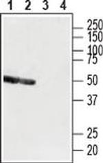 P2Y12 (extracellular) Antibody in Western Blot (WB)