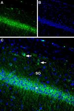 KV2.1 (KCNB1) Antibody in Immunohistochemistry (IHC)