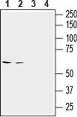 SLC6A14 (extracellular) Antibody in Western Blot (WB)
