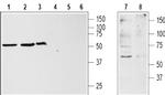KISS1R (extracellular) Antibody in Western Blot (WB)