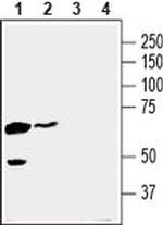 SLC16A3 Antibody in Western Blot (WB)