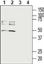 SLC16A3 Antibody in Western Blot (WB)