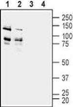 ADAM22 (extracellular) Antibody in Western Blot (WB)