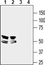 LRRTM1 (extracellular) Antibody in Western Blot (WB)