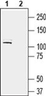 LRRC4B (extracellular) Antibody in Western Blot (WB)