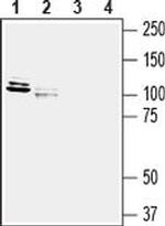 LRRC4B (extracellular) Antibody in Western Blot (WB)