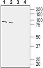 SLC1A4 Antibody in Western Blot (WB)