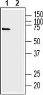 SLC9A6 Antibody in Western Blot (WB)