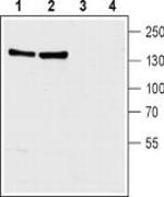 SLC8A1 Antibody in Western Blot (WB)