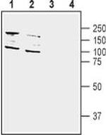 DPP10 (extracellular) Antibody in Western Blot (WB)